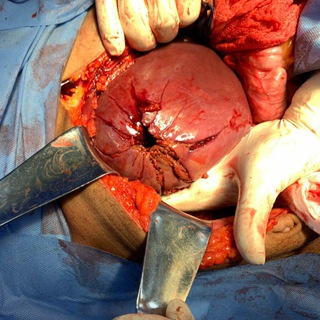Telegram profile photo for Cirugía General: Anatomía y fisiopatología.