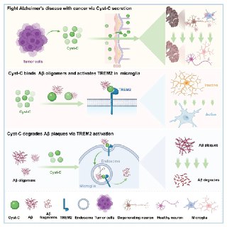 研究提示癌症与阿尔茨海默病风险下降相关：关键蛋白或起作用中国华中科技大学研究团队在《细胞》杂志发表研究显示，癌症相关机制涉及的胱抑素 C 蛋白质可能通过进入脑内并激活小胶质细胞相关通路，促进清除与阿尔茨海默病相关的错误折叠蛋白团块（如淀粉样斑块）。据媒体报道，该研究历时约 15 年，为解释癌症与阿尔茨海默病罕见共存的医学现象提供了分子层面的解释。研究人员在阿尔茨海默病小鼠模型中建立肺癌、前列腺癌和结肠癌相关肿瘤负荷，发现患癌小鼠的阿尔茨海默病特征性脑斑块显著减少/病理减轻。此前 2020 年一项涵盖 960