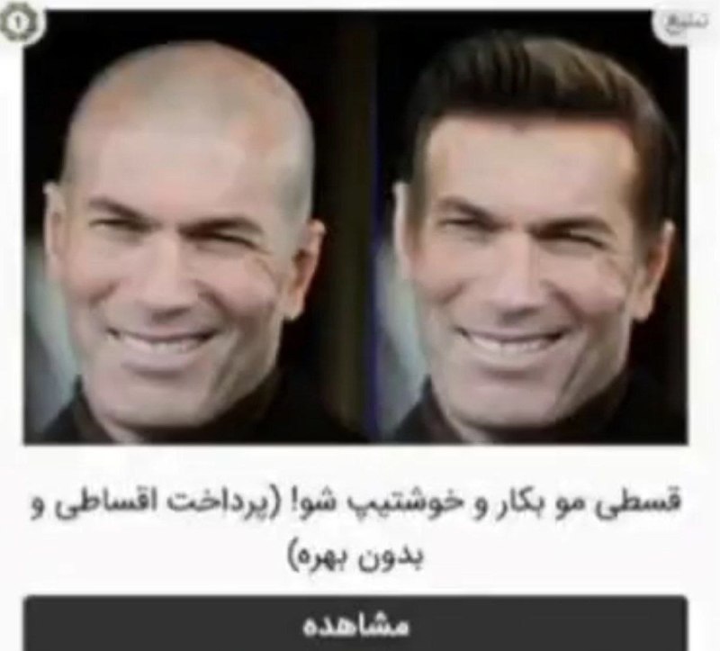 رئال مادرید | Real Madrid C.F: یهزمانی سایتهای کاشت موی ایران اینجوری تبلیغ میکردن: 😂😂🆔 @RealMadridFans🇪🇸| @RealMadridTweet | #mt
